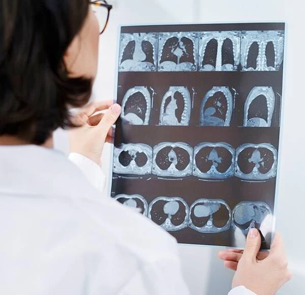 Finding The Best Open MRI In Delhi: Key Features And Benefits